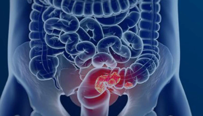 Uma imagem impressionante